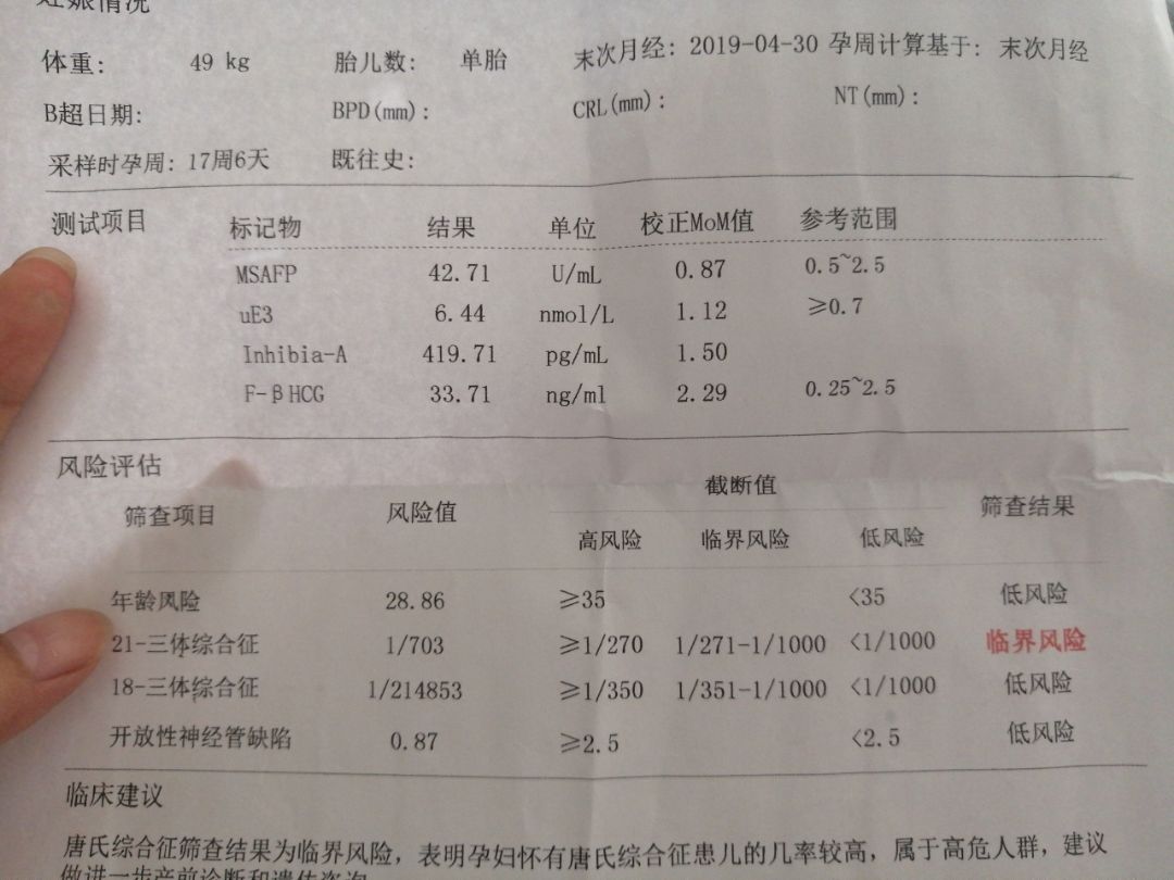 21三体综合征高风险18-21三体综合征高风险185家里没有遗传基因